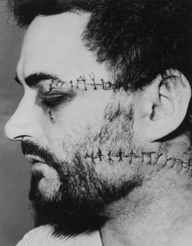 Portraits criminels par Swen : Peter Sutcliffe